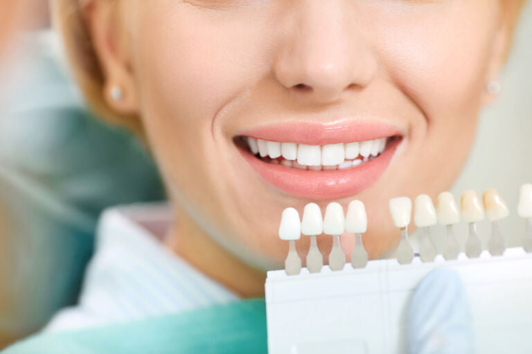 Is Professional Teeth Whitening Worth It?