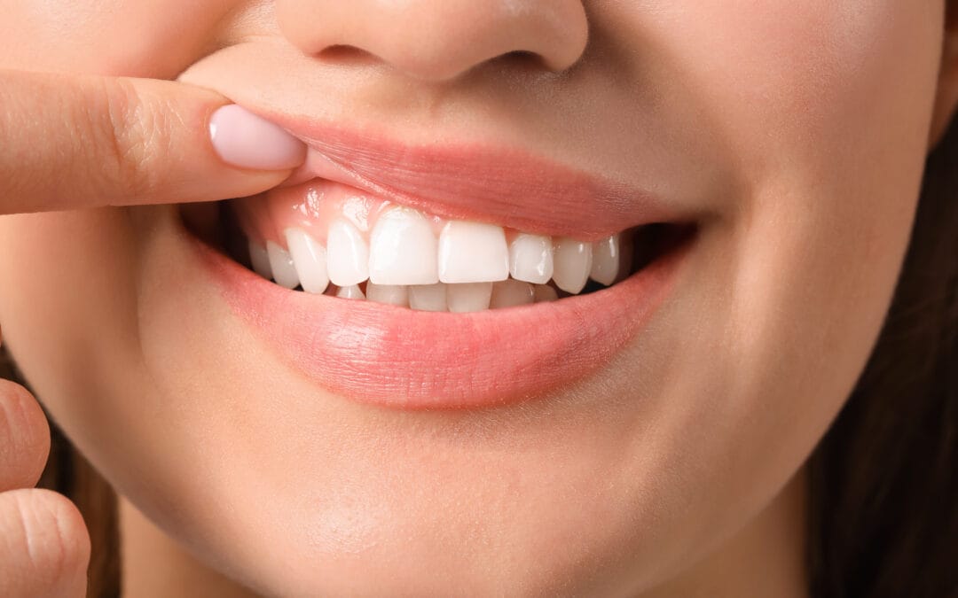 The Connection Between Gum Disease and Heart Health